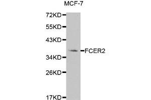 Western blot analysis of extracts of MCF-7 cell line, using FCER2 antibody. (FCER2 antibody)