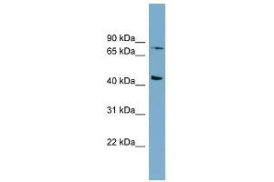 FZD6 antibody used at 1 ug/ml to detect target protein. (FZD6 antibody)
