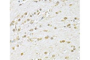 Immunohistochemistry of paraffin-embedded Rat brain using KU70 Polyclonal Antibody at dilution of 1:100 (40x lens). (XRCC6 antibody)