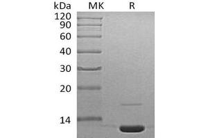 Western Blotting (WB) image for Complement Component 3 (C3) protein (ABIN7320494) (C3 Protein)