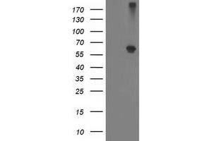 Western Blotting (WB) image for anti-Alcohol Dehydrogenase 1B (Class I), beta Polypeptide (ADH1B) antibody (ABIN1496479) (ADH1B antibody)