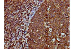 IHC image of ABIN7156089 diluted at 1:600 and staining in paraffin-embedded human tonsil tissue performed on a Leica BondTM system. (IGHM antibody  (AA 45-178))