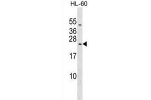 Western Blotting (WB) image for anti-Ribosomal Protein L10L (RPL10L) antibody (ABIN2999579)