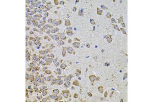 Immunohistochemistry of paraffin-embedded mouse brain using PIK3CA antibody (ABIN5970095) at dilution of 1/100 (40x lens).