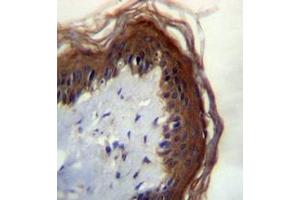 Immunohistochemistry analysis in formalin fixed and paraffin embedded human skin tissue reacted with LIPM Antibody (C-term) followed by peroxidase conjugation of the secondary antibody and DAB staining. (LIPM antibody  (C-Term))