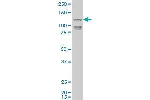 HEL308 polyclonal antibody (A01), Lot # 060703JCS1 Western Blot analysis of HEL308 expression in HL-60 . (HEL308 antibody  (AA 275-337))