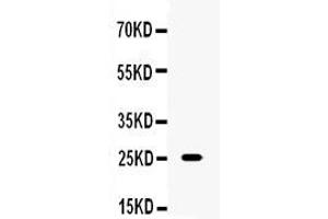 Western Blotting (WB) image for anti-Tumor Necrosis Factor alpha (TNF alpha) (AA 202-235), (C-Term) antibody (ABIN5518792)
