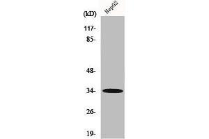 Western Blot analysis of HepG2 cells using Chemokine Receptor D6 Polyclonal Antibody (CCBP2 antibody  (C-Term))