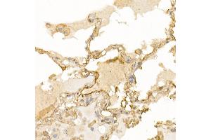 Immunohistochemistry (IHC) image for anti-Mesencephalic Astrocyte-Derived Neurotrophic Factor (MANF) (AA 25-182) antibody (ABIN6143461)
