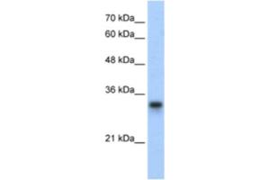 Western Blotting (WB) image for anti-Ribosomal Protein L8 (RPL8) antibody (ABIN2462053) (RPL8 antibody)
