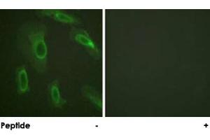 Immunofluorescence analysis of HeLa cells, using MUC1 polyclonal antibody . (MUC1 antibody)