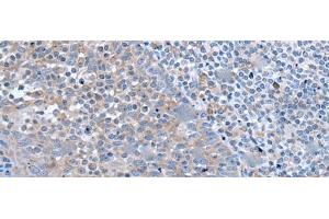 ZIC1 antibody