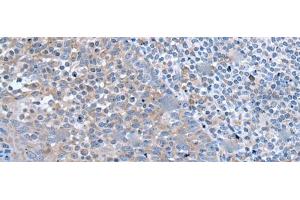 Immunohistochemistry of paraffin-embedded Human tonsil tissue using ZIC1 Polyclonal Antibody at dilution of 1:65(x200) (ZIC1 antibody)