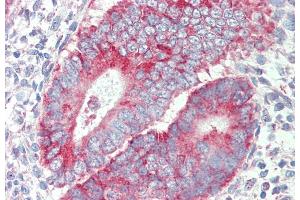 ABIN987282 (5 μg/mL) staining of paraffin embedded Human Uterus. (P2RX4 antibody  (Internal Region))