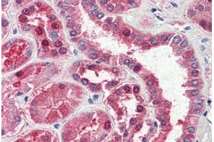 Human Kidney (formalin-fixed, paraffin-embedded) stained with GOT1 antibody ABIN337132 at 2. (GOT1 antibody  (AA 157-167))