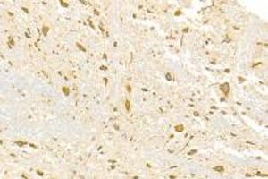 ADAMTS4 antibody