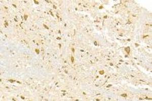 Immunohistochemistry analysis of paraffin-embedded rat spinal cord using ADAMTS4 (ABIN7072947) at dilution of 1: 3000 (ADAMTS4 antibody)