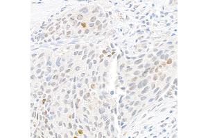 Immunohistochemistry (IHC) image for anti-gamma Histone Variant H2AX (GAMMA-H2AX) (Ser139) antibody (ABIN7448897) (gamma H2AX antibody  (Ser139))