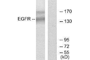 Western blot analysis of extracts from HT-29 cells, using EGFR (Ab-1172) antibody. (EGFR antibody  (Tyr1172))