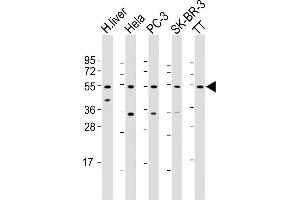 All lanes : Anti-THRB Antibody (N-Term) at 1:2000 dilution Lane 1: human liver lysate Lane 2: Hela whole cell lysate Lane 3: PC-3 whole cell lysate Lane 4: SK-BR-3 whole cell lysate Lane 5: TT whole cell lysate Lysates/proteins at 20 μg per lane. (THRB antibody  (AA 23-55))