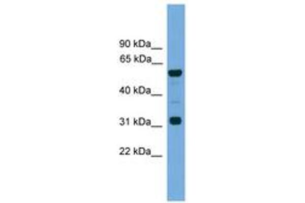 GJa10 anticorps  (N-Term)