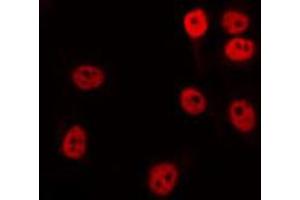 ABIN6274700 staining COS7 by IF/ICC. (RAD51 Homolog B antibody)