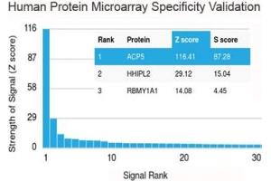 Analysis of HuProt(TM) microarray containing more than 19,000 full-length human proteins using recombinant TRAcP antibody (clone rACP5/1070). (ACP5 antibody)