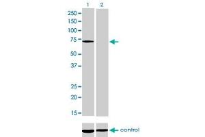 Western Blotting (WB) image for anti-Myotubularin 1 (MTM1) (AA 1-100) antibody (ABIN598823) (MTM1 antibody  (AA 1-100))
