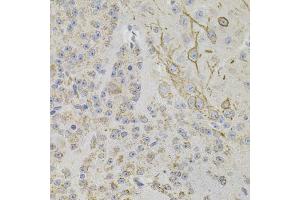 Immunohistochemistry of paraffin-embedded mouse brain using REG3A antibody (ABIN6132545, ABIN6146855, ABIN6146856 and ABIN6216122) (40x lens). (REG3A antibody  (AA 27-175))