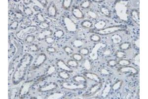 Detection of EDN1 in Human Kidney Tissue using Monoclonal Antibody to Endothelin 1 (EDN1) (Endothelin 1 antibody  (AA 53-90))