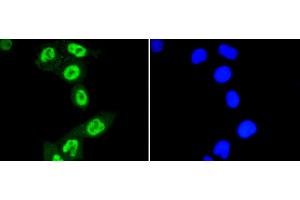 HeLa cells were fixed in paraformaldehyde, permeabilized with 0. (STAT3 antibody  (pSer727))