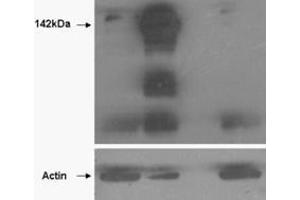 HEK293 overexpressing TANK1 (lane 2) and TANK2 (lane 4) and probed with ABIN570900 (mock transfection in first lane). (TNKS antibody  (N-Term))