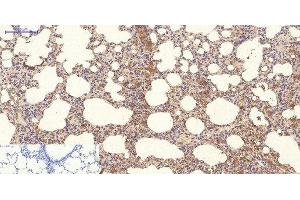 Immunohistochemistry of paraffin-embedded Rat lung tissue using NBR1 Monoclonal Antibody at dilution of 1:200. (NBR1 antibody)
