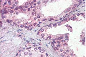 ABIN335143 (5µg/ml) staining of paraffin embedded Human Prostate. (IFNAR2 antibody  (Internal Region))