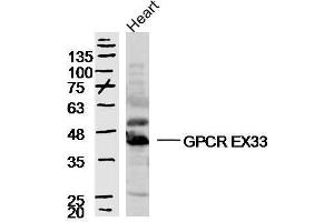 Mouse heart lysates probed with GPCR EX33 Polyclonal Antibody, unconjugated  at 1:300 overnight at 4°C followed by a conjugated secondary antibody at 1:10000 for 90 minutes at 37°C. (GPR84 antibody  (AA 21-120))