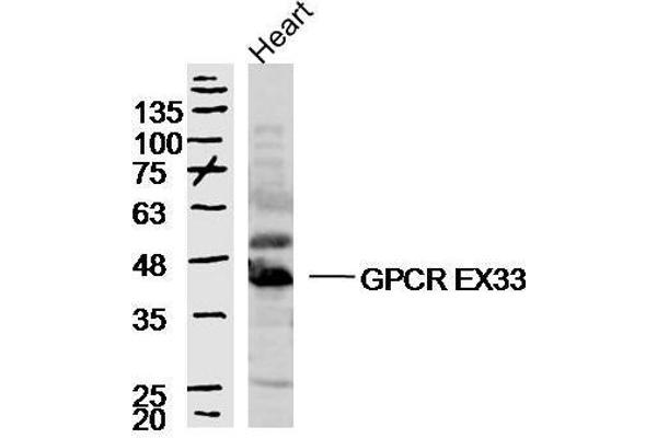 GPR84 抗体  (AA 21-120)