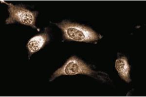 Immunofluorescent staining of Human Endothelial cells. (JAK1 antibody  (AA 551-766))