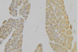 ABIN6276630 at 1/100 staining Human pancreas tissue by IHC-P. (IL7R antibody  (N-Term))