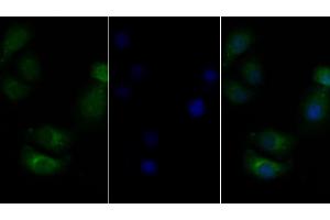 Detection of CSF2Rb in Human Hela cell using Polyclonal Antibody to Colony Stimulating Factor 2 Receptor Beta (CSF2Rb) (CD131 antibody  (AA 133-233))