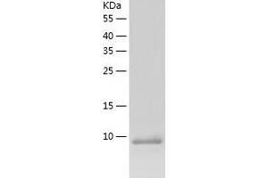 Western Blotting (WB) image for Artemin (ARTN) (AA 108-220) protein (His tag) (ABIN7287518) (ARTN Protein (AA 108-220) (His tag))