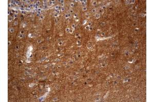 Image no. 1 for anti-Visinin-Like 1 (VSNL1) (AA 2-191) antibody (ABIN1491124) (VSNL1 antibody  (AA 2-191))