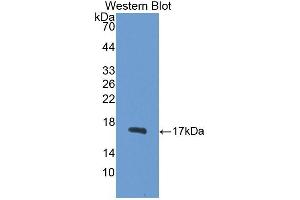 Detection of Recombinant SNCg, Rat using Polyclonal Antibody to Gamma-synuclein (SNCG) (SNCG antibody  (AA 1-123))