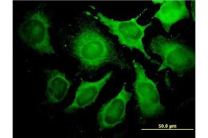 Immunofluorescence of monoclonal antibody to ALDOA on HeLa cell. (ALDOA antibody  (AA 1-364))