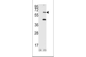 Western Blotting (WB) image for anti-Eukaryotic Translation Initiation Factor 2-alpha Kinase 2 (EIF2AK2) (AA 11-42), (N-Term) antibody (ABIN392778)