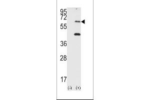 Western blot analysis of EIF2AK2 (arrow) using PRKR Antibody (N-term) (ABIN392778 and ABIN2837994). (EIF2AK2 antibody  (N-Term))