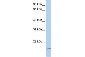 WB Suggested Anti-ASCL4 Antibody Titration:  0. (ASCL4 antibody  (N-Term))