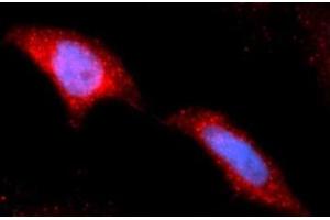 Immunofluorescence (IF) image for anti-Hexokinase 2 (HK2) (AA 1-917) antibody (APC) (ABIN5565592) (Hexokinase 2 antibody  (AA 1-917) (APC))