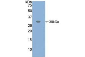 Detection of Recombinant ATF6, Human using Polyclonal Antibody to Activating Transcription Factor 6 (ATF6) (ATF6 antibody  (AA 423-646))