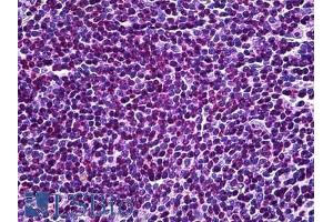ABIN184976 (3. (UBR5 antibody  (C-Term))
