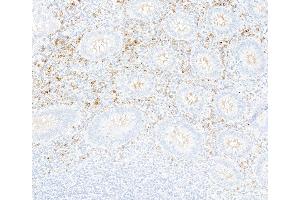 Immunohistochemistry (IHC) image for anti-Interferon alpha/beta Receptor 1 (IFNAR1) (AA 27-436) antibody (ABIN7795661) (Recombinant IFNAR1 antibody  (AA 27-436))